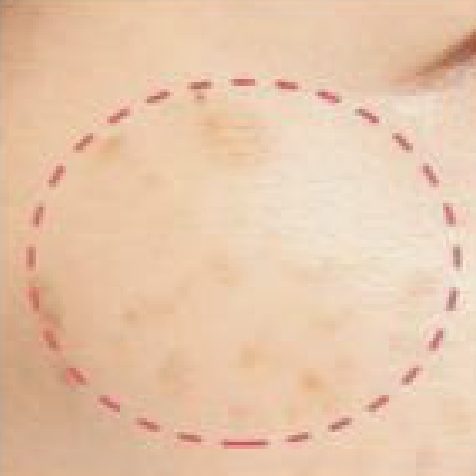 症例写真 使用前